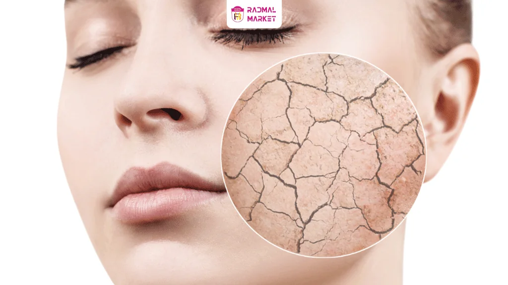 منظور ازسرم کپسولی هیدرو بوست نیتروژینا چیست؟