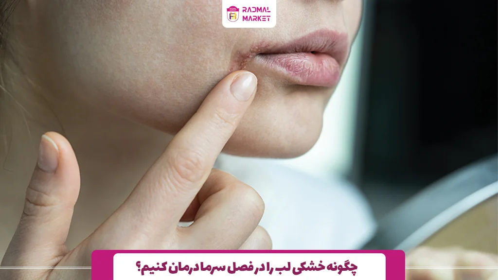 چگونه خشکی لب را در فصل سرما درمان کنیم؟ 